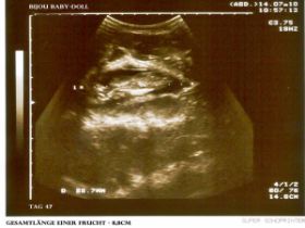 Ultraschallbild eines Katzenbabies